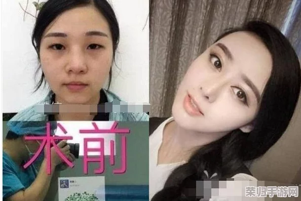 全面解锁整容通关秘籍：分步图文详解，从术前准备到术后护理的完整指南