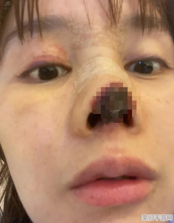 全面解锁整容通关秘籍：分步图文详解，从术前准备到术后护理的完整指南