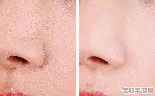 深度对比：反恐精英护肤喷雾VS专业毛孔管理产品，谁才是肌肤细腻无瑕的优选？
