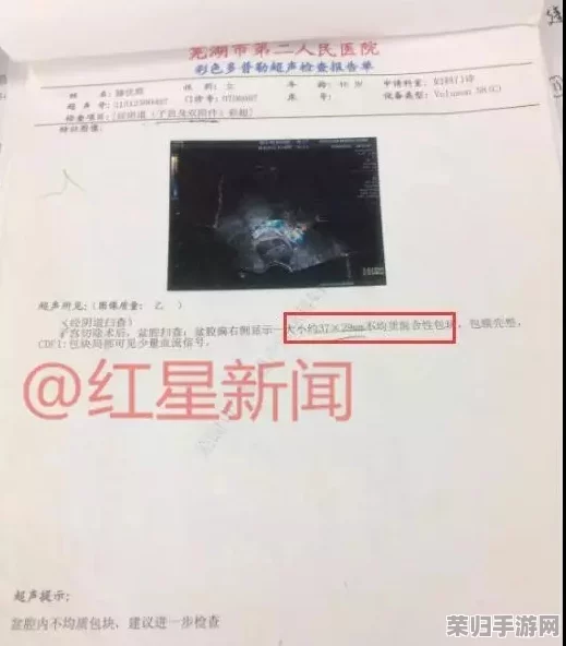 毛茸茸妇女体内汇编：探寻自然之美，感受生命的奇迹