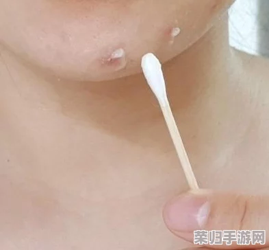 棉签加酒精等于牛奶(黄)：理解这一奇特现象背后的科学原理与实际应用