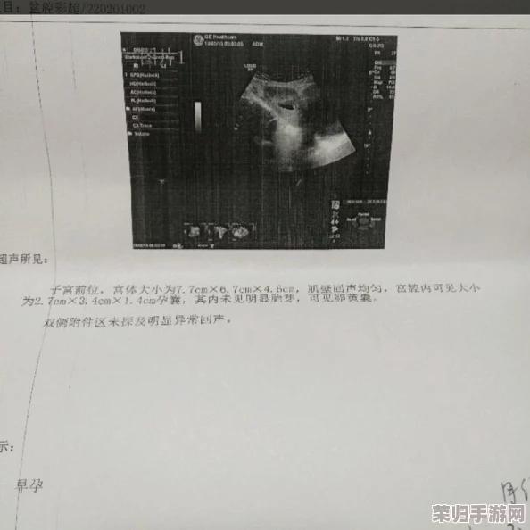 医生边做B超边给我解释，我好爽