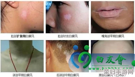 胡桃流出白色脓状物，网友惊呼：这是什么情况？难道是生病了还是正常现象？求专业人士解答！