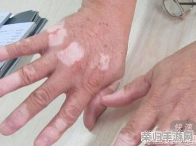 胡桃流出白色脓状物，网友惊呼：这是什么情况？难道是生病了还是正常现象？求专业人士解答！