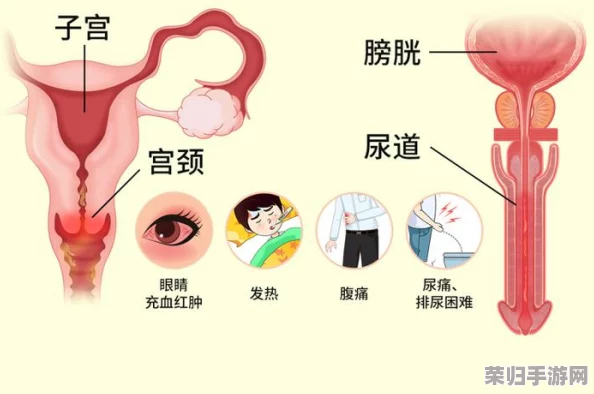 胡桃尿道口流出白色脓状物是什么？了解可能的原因及相关症状，帮助你更好地判断健康问题